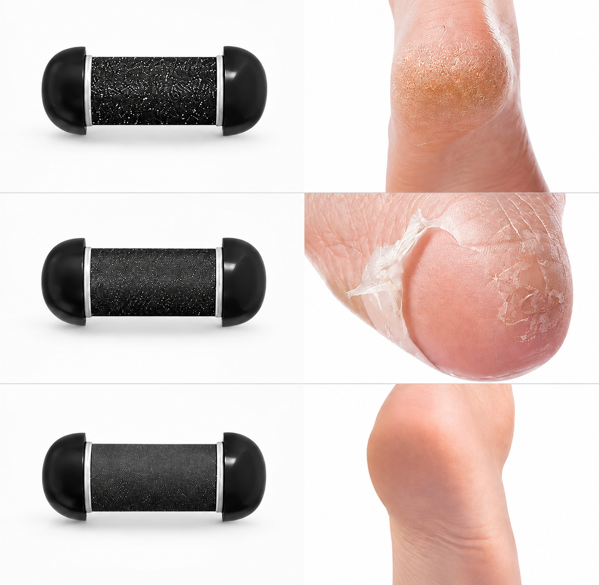 Aparelho Elétrico para Remover Calosidades